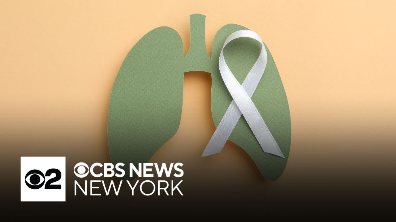 Lung cancer screening guidelines may need to expand, research shows