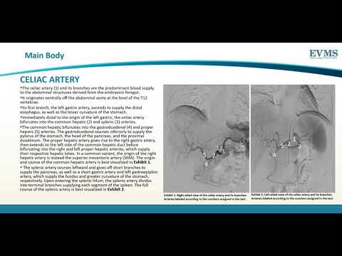 Thumbnail image of video presentation for Vascular Supply of the Abdomen on Angiography