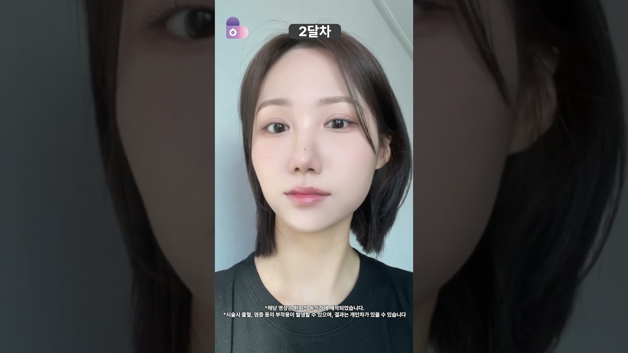 '코'라인 하나로, 연프 비주얼 완성!