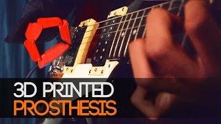 3Dglück: Teen Can Play Guitar Thanks To A 3D-Printed Prosthetic Hand