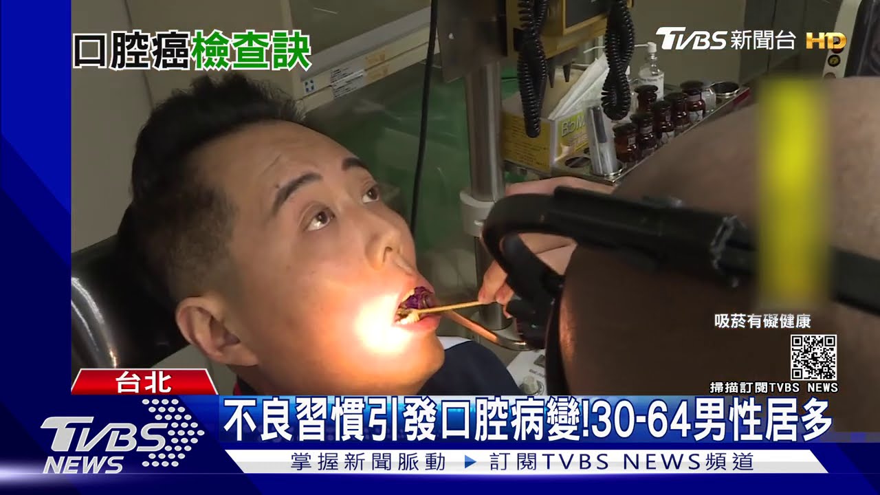 台灣平均每天9人死於口腔癌 醫:口腔黏膜自我檢查有異狀需就醫