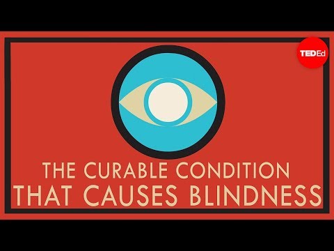 【TED-Ed】A curable condition that causes blindness - Andrew Bastawrous