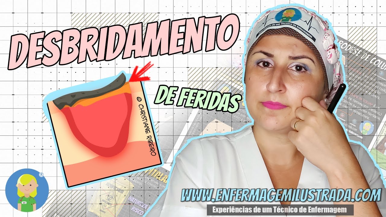 DESBRIDAMENTO DE FERIDAS: Entenda como funciona!