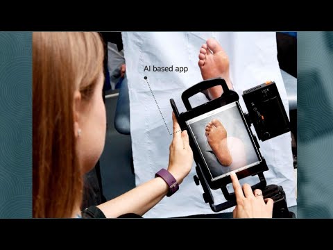 Medical AI provides feedback in 20 seconds using OCI