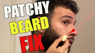 The SECRET to Curing a Patchy Beard! *The Untold Remedy*