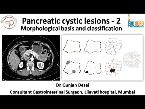 Pancreatic cystic lesions - morphology based classification of pancreatic cysts - Part 2
