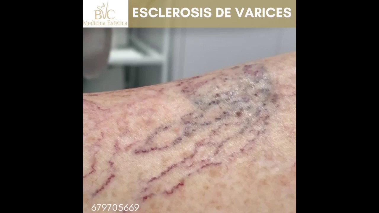 Paulina Pérez Ramírez-22