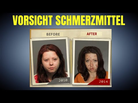 Die 10 stärksten Schmerzmittel DER WELT!