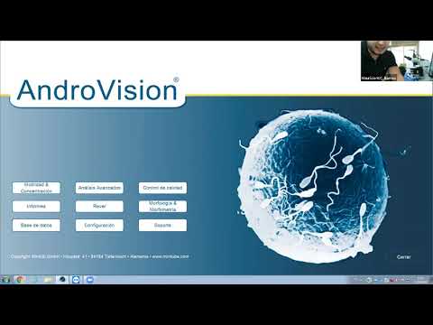 Sistema CASA Androvision. Tencología de alta precisión. Conocé la importancia de esta herramienta