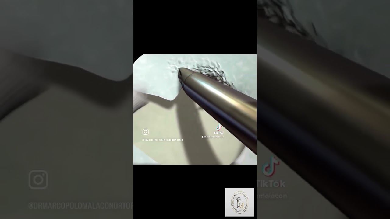 Marco Polo Malacón Gutiérrez-30