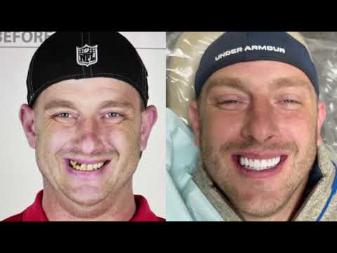 Jack’s ALL-ON-4 Smile Transformation