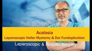 Miniaturka - Acalasia / Laparoscopic Heller Myotomy + Dor Fudoplication. Metin Ertem MD FACS.