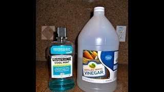 {28} Listerine and Vinegar Foot Soak..Does it Really Work Wonders?