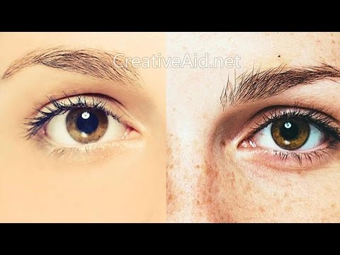 How to Get Rid of Freckles and Blemishes Fast and...
