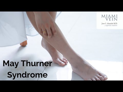 May-Thurner Syndrome Causes, Symptoms & Treatment Guide