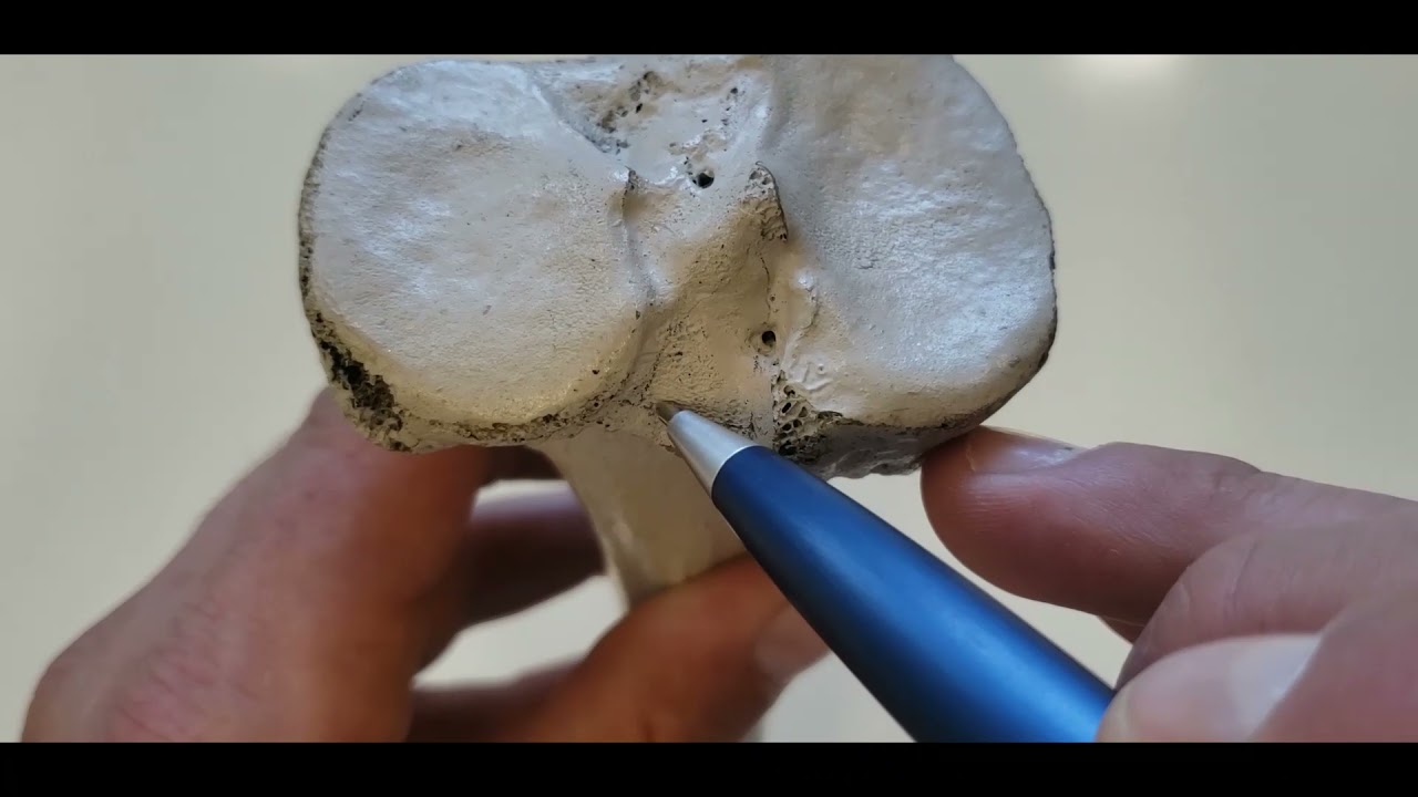 VÍDEO AULA PRÁTICA OSSOS DE MEMBRO INFERIOR PARTE 3 - TÍBIA, PATELA E OSSOS DO PÉ