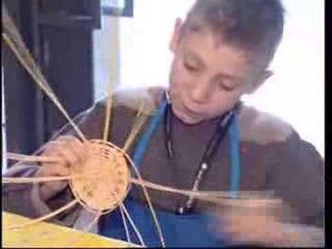 Rimedio per i dolori articolari in spalla Displasia dellanca nei bambini, dopo un anno di trattamento