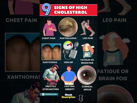 High Cholesterol Symptoms: What Your Body Is Trying to Tell You