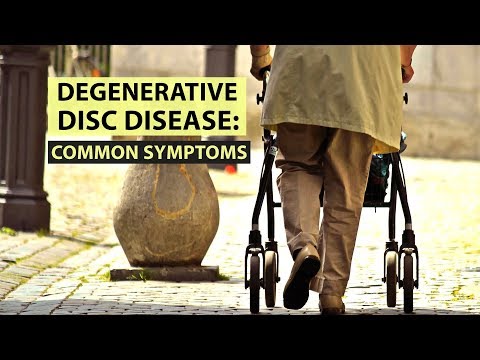 Schmerzen im Nacken, Kopf und Händen Zeichen der Osteochondrose des Halsbereichs