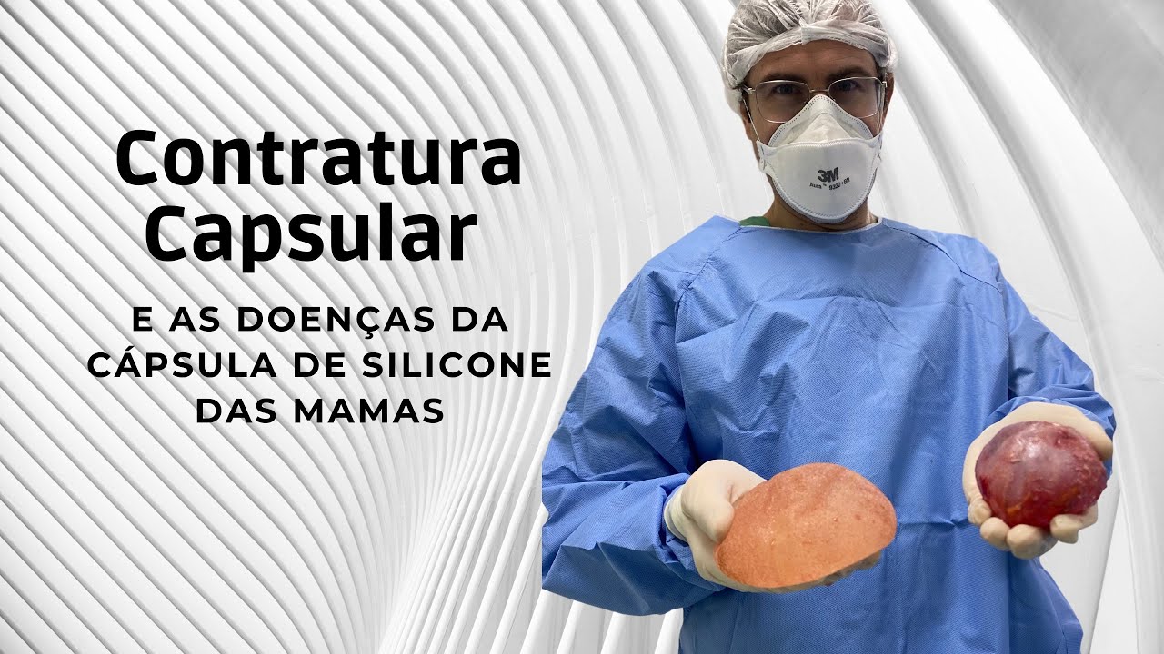 CONTRATURA CAPSULAR e DOENÇAS DO SILICONE | Dr. Francisco Claro Jr.