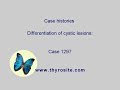 Differentiation Of Cystic Lesions Case 1297