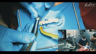 Bonding Uygulaması-Kodaz Dental Aesthetic-Dr. Tolga KODAZ