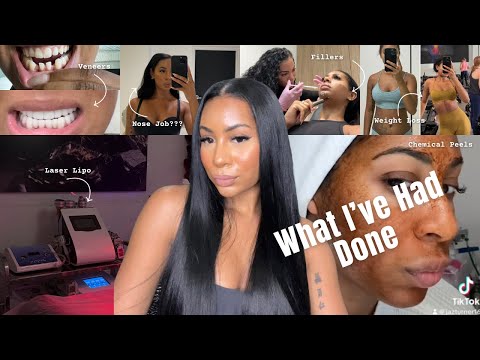 WHAT I'VE HAD DONE | fillers, botox, veneers, nose job?? //honest + real af//
