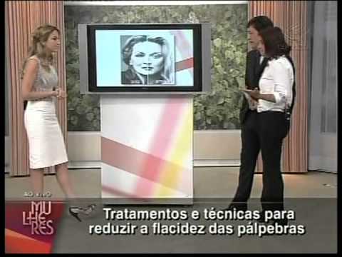 Flacidez das pálpebras - Clínica Martinez - Mulheres -  24.01.2013