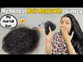 My Hair Loss Hair Regrowth Journey Sharing My Story ️
