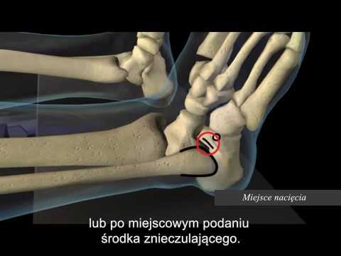 Darmowe buty ortopedyczne dla dzieci z deformacją koślawego Guzki na palcach się, że ten