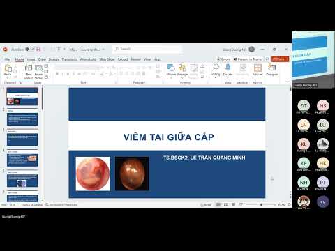 Tai Mũi Họng - Viêm tai giữa cấp/mạn - 31/10/2023