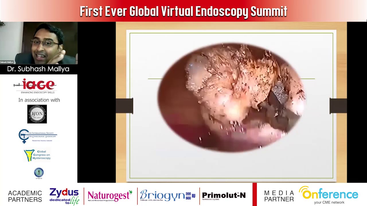 Dr. Subash Mallya speaks at IAGE Conference