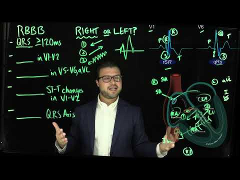 Right bundle branch block simplified | The EKG Guy - www.ekgguy.com