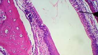 Histologia das Fossas nasais