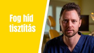 Fogászati híd pótlás tisztítása