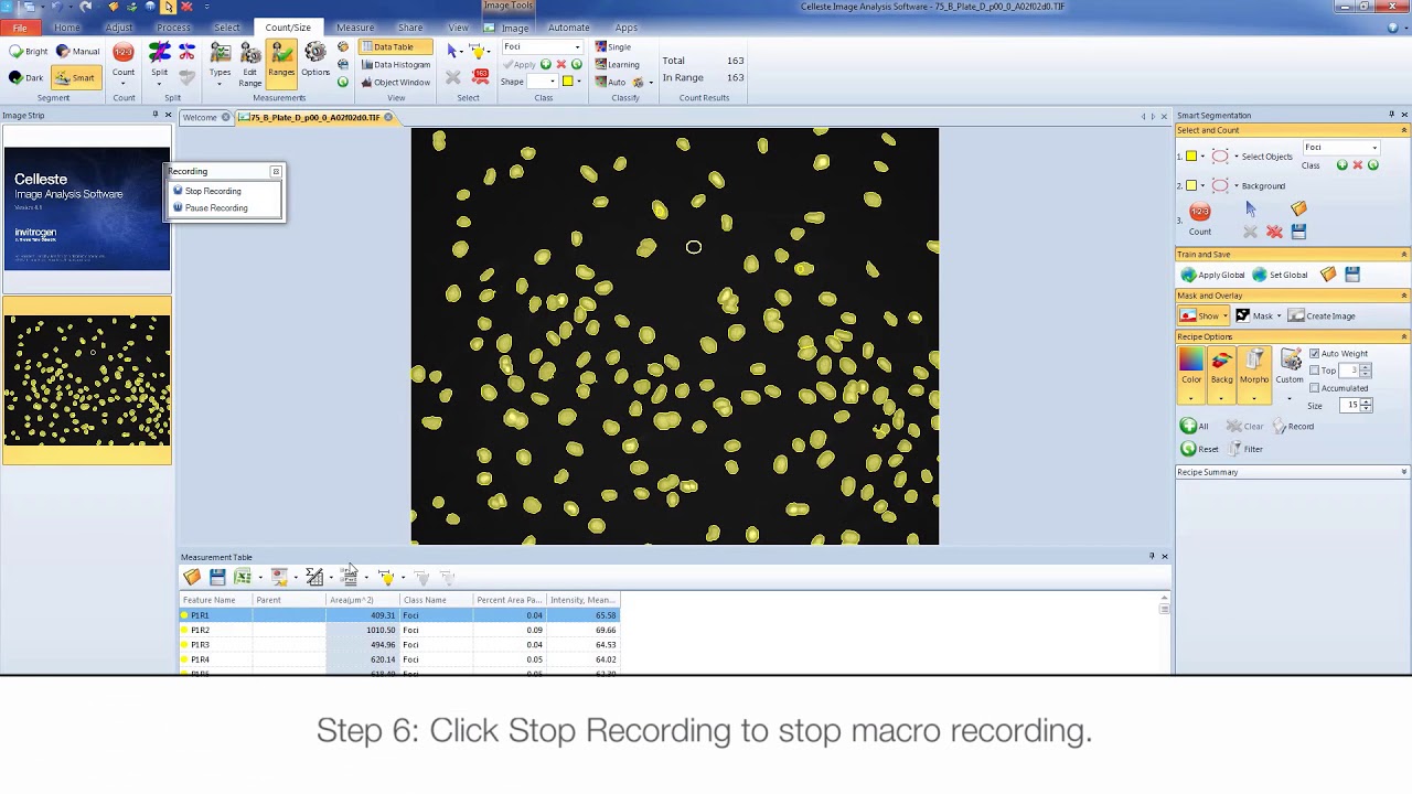 Beginner's guide to macro writing: Celleste Image Analysis Software