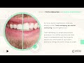 [GMedia] Dental Storytelling: What is Tooth Reshaping, AKA Dental Contouring?
