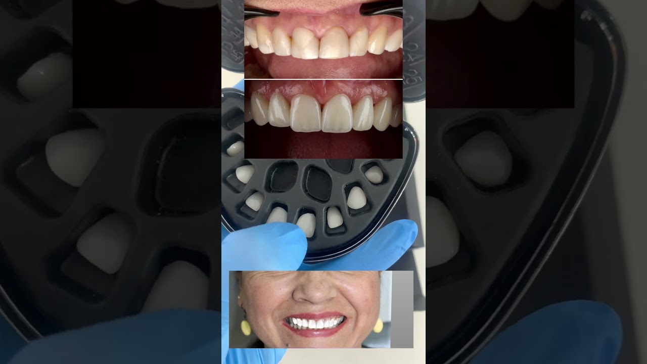 Andersson Buritica-17