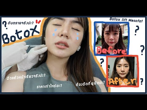 โบท็อก ที่ไหนดี