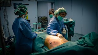 Cómo es una operación de ginecomastia