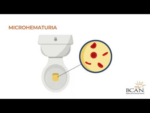 Video: What is hematuria? – Bladder Cancer Advocacy Network