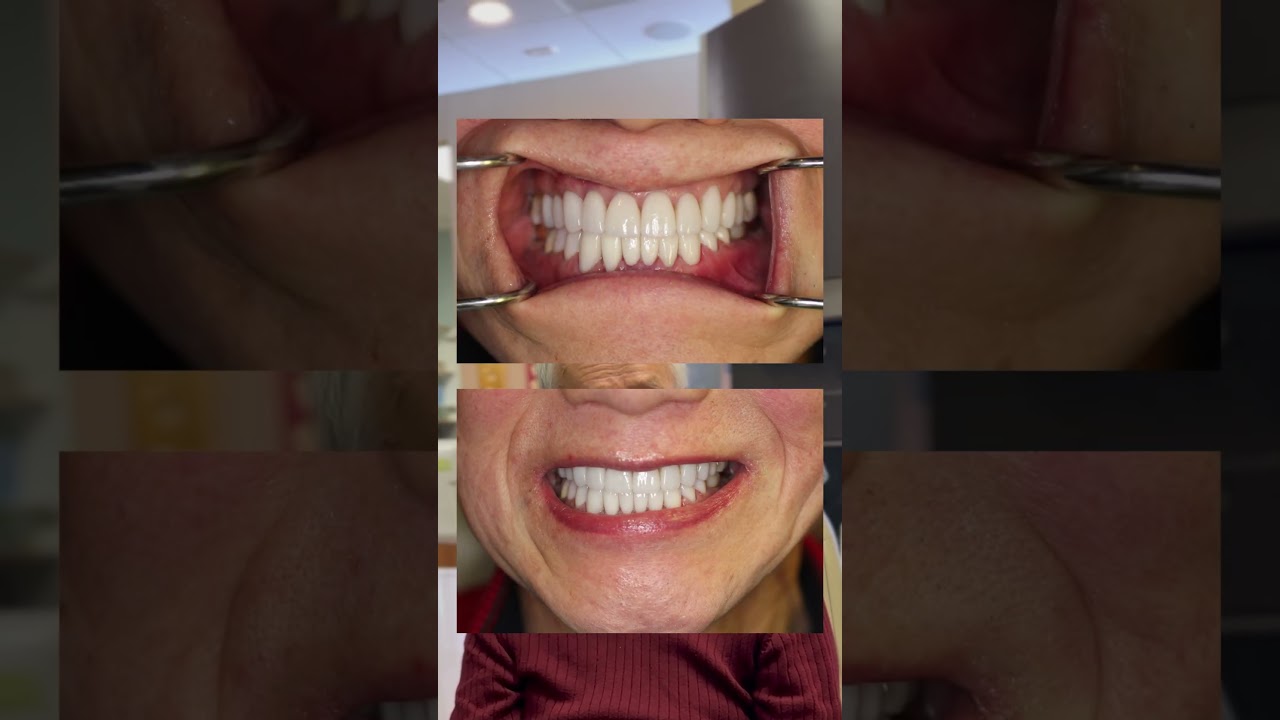 Patient Testimonial 19