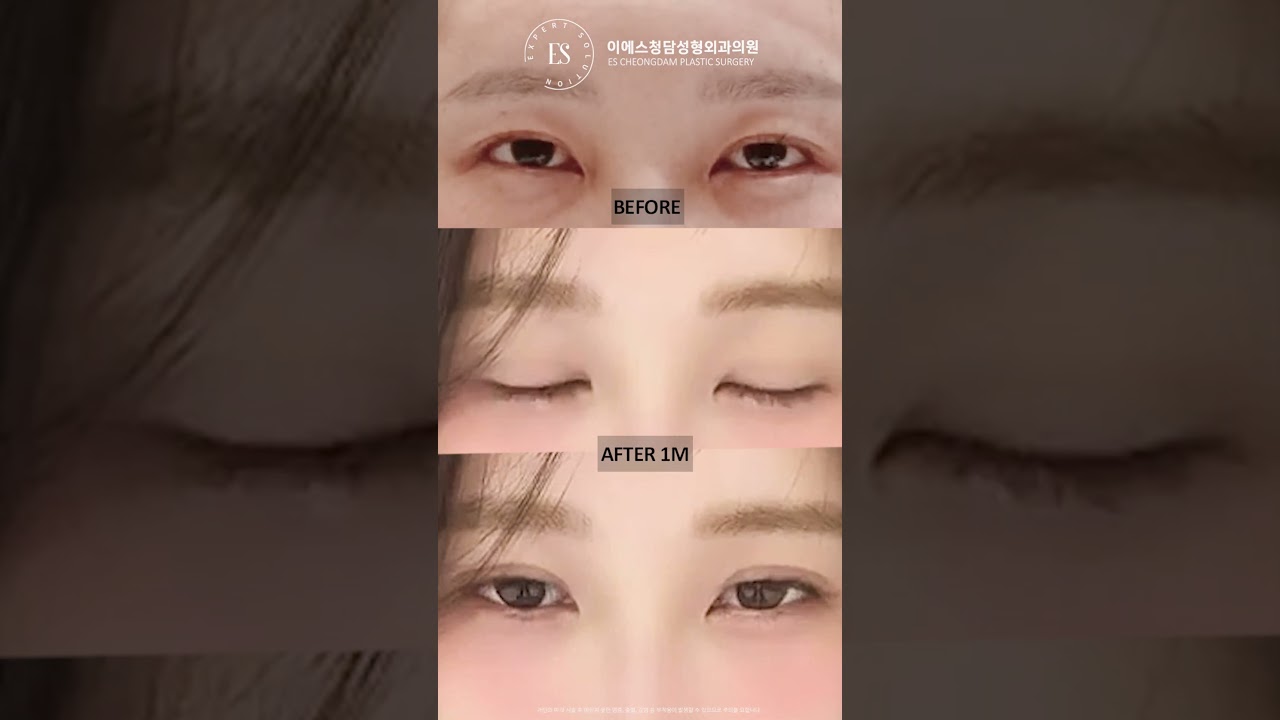 이에스 유튜브