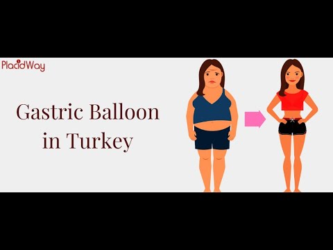 Watch Gastric Balloon in Turkey