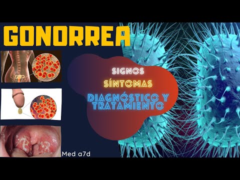 image-¿Qué es la gonorrea y si tiene cura?