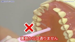 歯間ブラシの正しいブラッシング方法