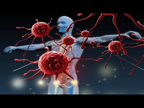 Ce se va întâmpla dacă locuiți în varicoză
