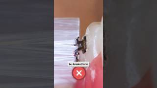 DİŞ TELLERİ NASIL FIRÇALANIR ?