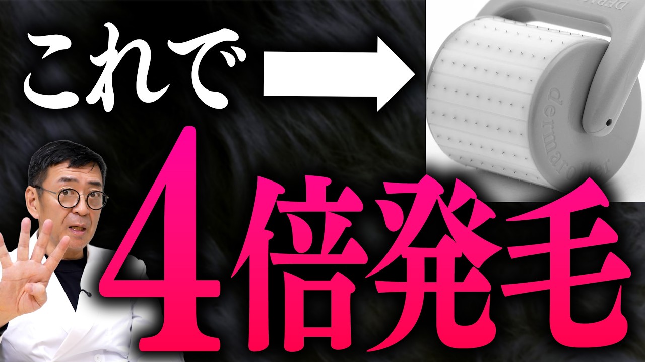 ダーマローラーの発毛効果がヤバすぎる！ミノキシジルを塗るだけじゃ生えない薄毛問題を終わらせろ【医師解説】