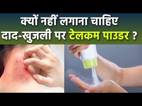 दाद खुजली पर टेलकम पाउडर लगाना चाहिए या नहीं |Skin Rashes Par Talcum Powder Lagana Chahiye Ya Nahi